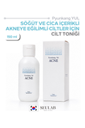 ACNE Toner - Akne Karşıtı Tonik 150 ml
