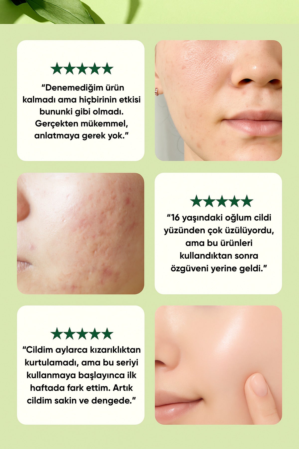 Ultimate Calming Solution Toner Yoğun Yatıştırıcı ve Nemlendirici Tonik 110 ml